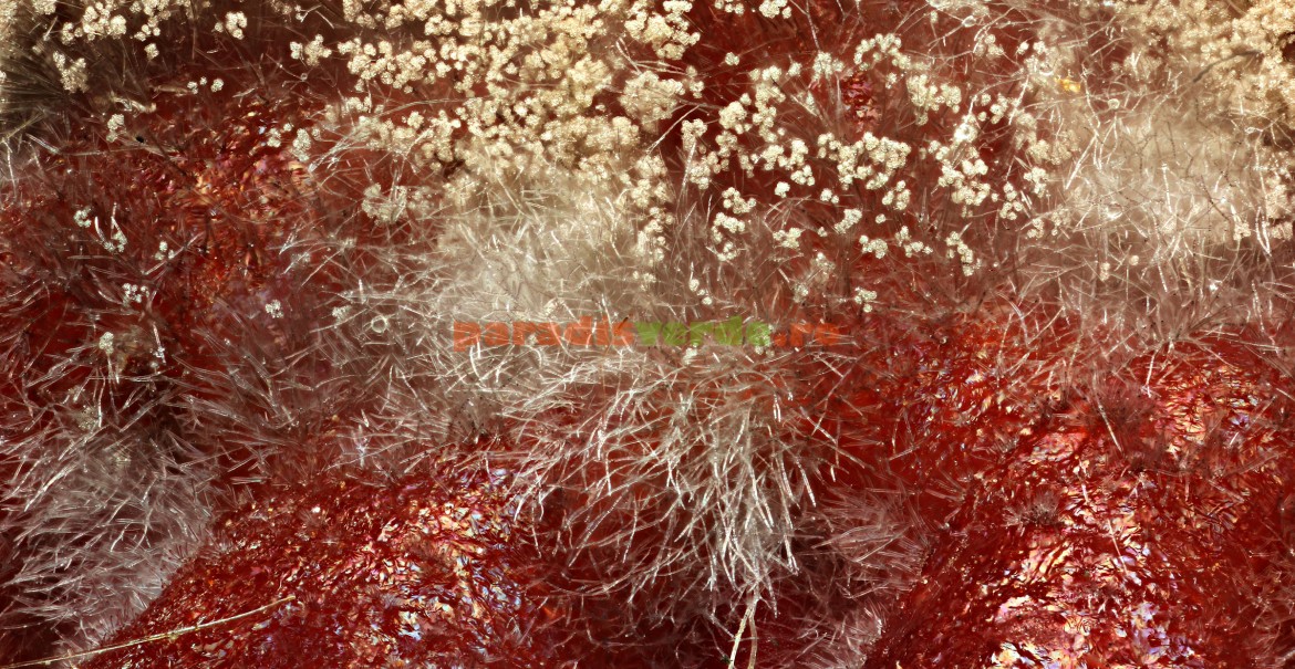 Infecție cu putregai cenușiu, văzută la microscop